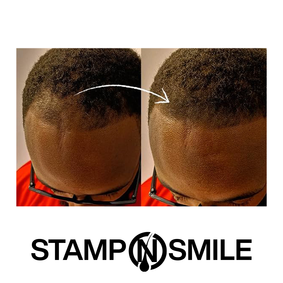 Stamp & Smile Kit