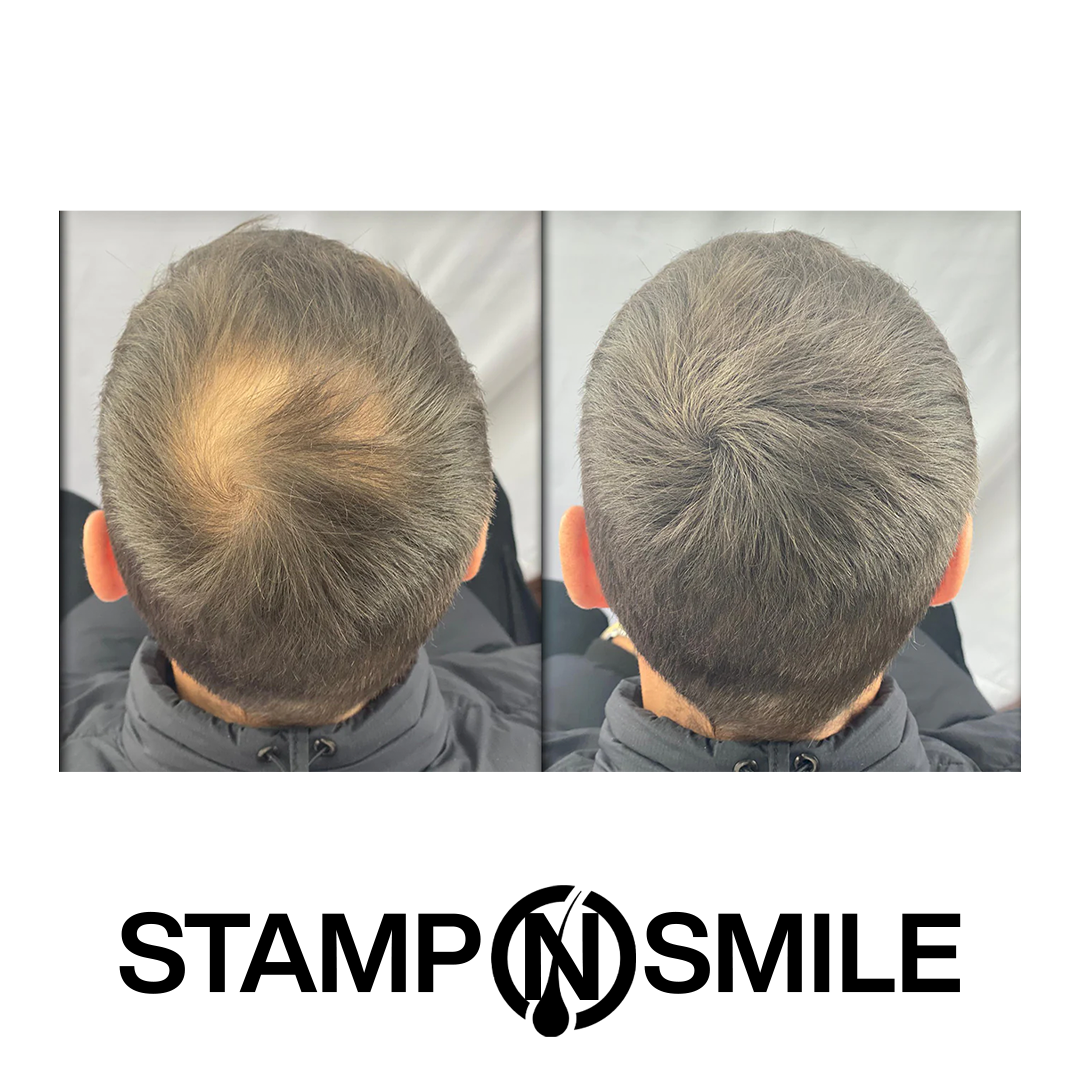 Stamp & Smile Kit